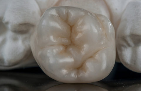 Tooth Genie Dental Lab - Tampa, Florida Full Service Dental Lab
