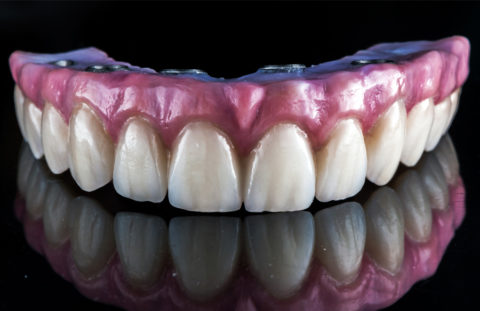 Tooth Genie Dental Lab - Tampa, Florida Full Service Dental Lab